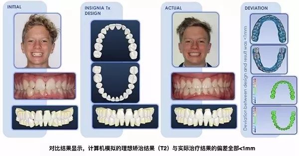 牙齿前沿技术引领口腔健康新时代