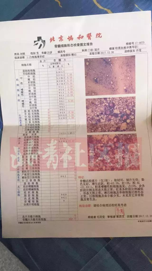 骨髓纤维化最新疗法突破，带来治疗的新希望