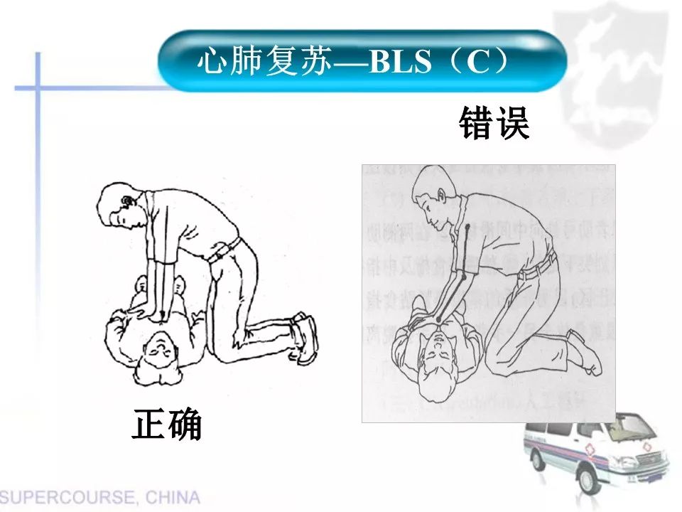 心肺复苏最新实践版本，实践与改进的探索